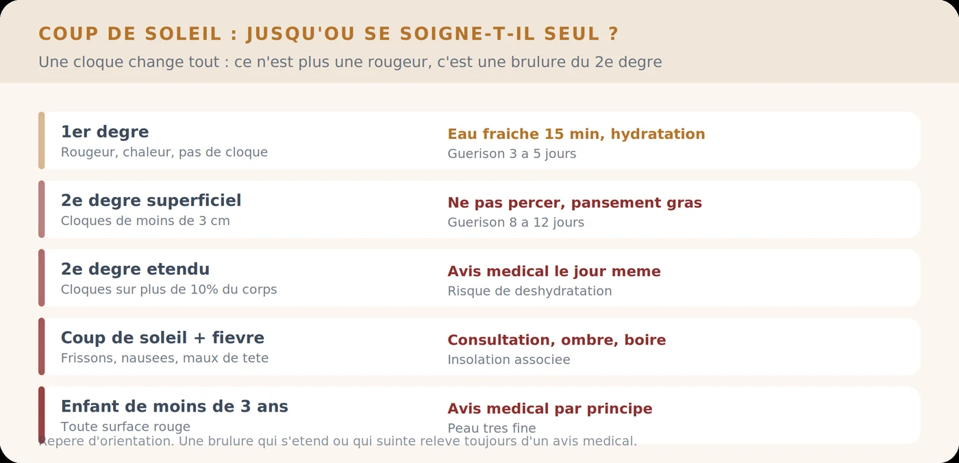 Jusqu&rsquo;où un coup de soleil se soigne seul